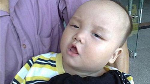 吃瓜吃完舌头疼,揭秘吃瓜引发的舌头疼之谜