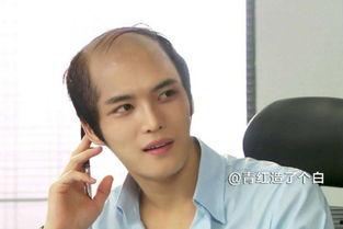 秃头明星都有谁,那些勇敢面对秃顶的明星风采